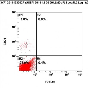 Photos  n° 3  : Graphes de la cytométrie en flux du même cas montrant la prolifération de lymphocytes T Helper (Crédit Dr Stéphanie LAFARGE, laboratoire VEBIO). Le graphe de gauche montre un marquage CD21 (lymphocytes B) quasi inexistant (1%, cadrant E1) Le graphe de droite indique un marquage de la quasi-totalité de la population lymphocytaire dans le cadrant D2 (92.4%), comme CD5+ (lymphocyte T) et CD4+ (Helper)  