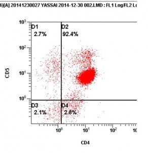 Photos  n° 4 : Graphes de la cytométrie en flux du même cas montrant la prolifération de lymphocytes T Helper (Crédit Dr Stéphanie LAFARGE, laboratoire VEBIO). Le graphe de gauche montre un marquage CD21 (lymphocytes B) quasi inexistant (1%, cadrant E1) Le graphe de droite indique un marquage de la quasi-totalité de la population lymphocytaire dans le cadrant D2 (92.4%), comme CD5+ (lymphocyte T) et CD4+ (Helper)  